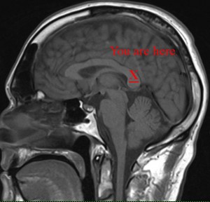 Brain Shot with text